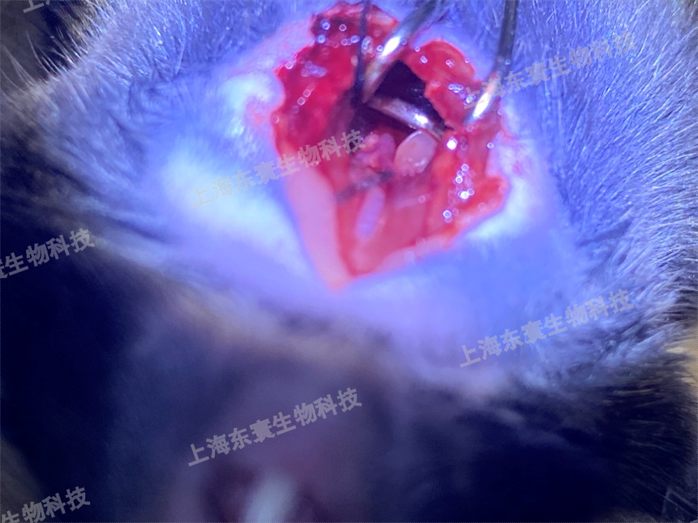 主動脈弓縮窄（ transverse aortic constriction，TAC）模型建立